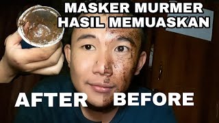 MASKER KOMEDO MURMER CABUT SEMUA KOMEDOO SAKITT TAPI PUASS LIHAT HASILNYA [upl. by Prochora]