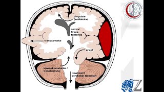 Intracranial Pressure 4 Herniation Syndromes 1 ضغط المخ [upl. by Bowrah]