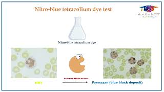 Nitroblue Tetrazolium test  NEETMDS  INICET AcetheNEET [upl. by Lyrehs]