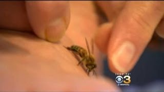 Health Bee Sting Therapy Can Help Common Health Problems [upl. by Brinkema]