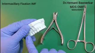 Intermaxillary Fixation IMF or Maxillomandibular Fixation MMF By Dr Hemant Baonerkar [upl. by Andrej]