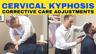 Cervical Kyphosis Corrective Chiropractic Care Adjustments  Dr Walter Salubro [upl. by Penthea176]