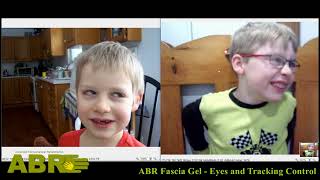 ABR Fascia Gel  Eye amp Tracking Control Progress Video 3 of 3 By Leonid Blyum [upl. by Chelton390]