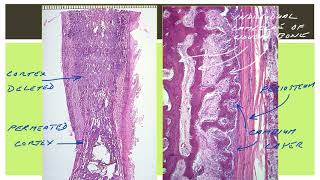 Osteogenesis 1  Basic Concepts [upl. by Willard]