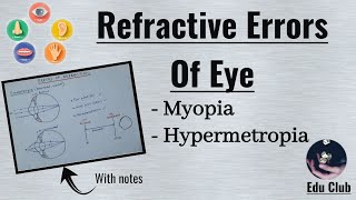 Refractory Errors Of Eye  Myopia  Hypermetropia  Special Senses Physiology [upl. by Isaak]