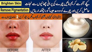 Worlds Best Whitening amp Pigmentation Removal Cream Remove DarkSpots Melasma Lighten Dull DarkSkin [upl. by Annala]