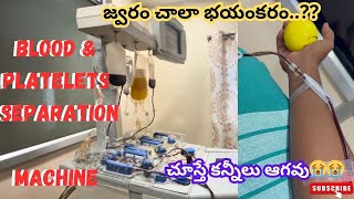 జ్వరం వచ్చి రక్తకణాలు తగ్గిపోయేవి critical situation  Low Blood Platelets in thphoid fever [upl. by Anyak]