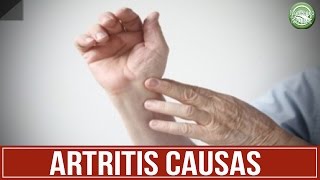 ARTRITIS Sintomas y Causas  Artritis Reumatoide [upl. by Constantino]