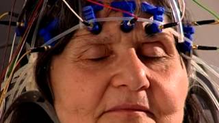 EEG  Elektroenzephalographische Untersuchung im nerv zentrum für neurologie Zürich [upl. by Ennahtur960]