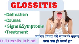 GlossitisDefinition causes signampSymptoms treatment Glossitis full Details tongue disorder [upl. by Kcirad626]