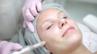 Reviderm Micro Needling  Sugaringqueen Erfurt [upl. by Auqinom]