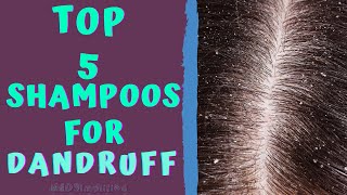 BEST SHAMPOOS FOR DANDRUFF  TOP ANTIDANDRUFF SHAMPOOS [upl. by Wit472]