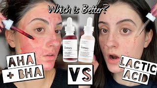 THE ORDINARY AHA  BHA PEELING SOLUTION VS LACTIC ACID  Which Chemical Exfoliator is Best for You [upl. by Atiuqehc]