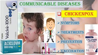 MEDICINAL TREATMENTS OF CHICKENPOX SYMPTOMS  PREVENTION AND VACCINATION [upl. by Adnilem]