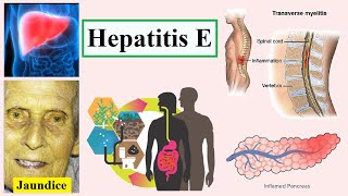 hepatitis E [upl. by Kerry943]