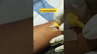 Iv cannulations💉 cannulation ytshortsindia cannulation mujjuu14 MiaBiwiWinees [upl. by Hanej]