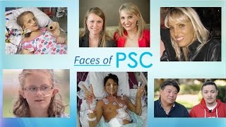 Faces of Primary Sclerosing Cholangitis PSC [upl. by Us979]