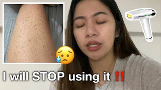 I will STOP USING Lescolton IPL DIY Laser in my legs  Ricalyn D [upl. by Fedak]