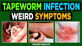 10 Weird Symptoms of Tapeworm Infection Skin Psychological Neurological [upl. by Ellerol]