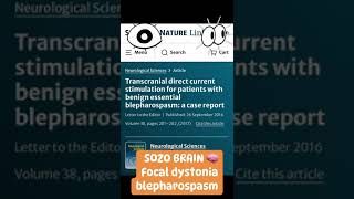 Blepharospasmus Okt24  Dystonia  Blepharospams cured with Neuromodulation [upl. by Luemas]