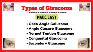 Glaucoma and its types types of glaucoma pharmacology glaucoma symptoms and treatment [upl. by Iris]