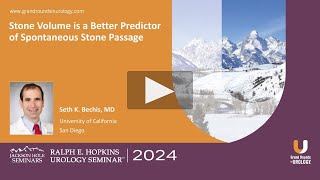 Stone Volume is a Better Predictor of Spontaneous Stone Passage [upl. by Hertzog947]