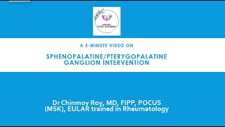 5Minute Video sphenopalatine ganglion block [upl. by Kinson]