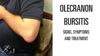 Olecranon bursitis Signs symptoms and treatment of the elbow problem [upl. by Ymor]