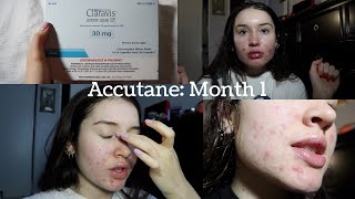 MY ACCUTANE JOURNEY Month 1 Update [upl. by Annaili]