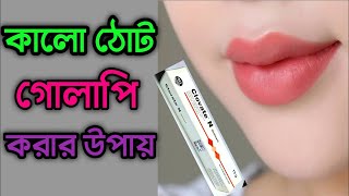 ঠোটের কালো দাগ দূর করার উপায় Tother kalo dag dur korar upay জেনে নিন কালো ঠোট গোলাপি করার ক্রিম [upl. by Jenesia]