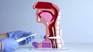 Tracheostomy TOM Cuff Deflation [upl. by Salman]