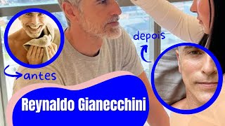 Reynaldo Gianecchini faz rejuvenescimento facial [upl. by Ciaphus]