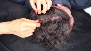 SCRAPING MY BOYFRIEND’S SCALP WITH NAILS  DANDRUFF SCRAPING WITH NAILS COMB amp BRUSH [upl. by Icaj543]