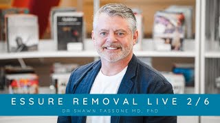 Essure Removal 26 with Dr Shawn Tassone [upl. by Ed]