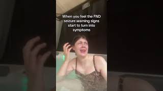 Functional neurological disorder FND causes non epileptic seizures [upl. by Eiggam]