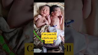 Cutest Twin Newborn Baby girl amp Baby boy First Cry immediately AfterBirth [upl. by Leverett]