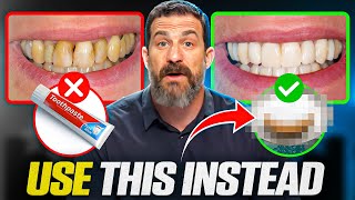 Neuroscientist quotToothpaste Is Damaging Your Teethquot How To Take Care of Your Teeth [upl. by Enileme]