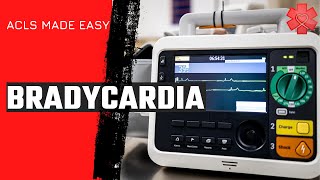 ACLS Bradycardia Algorithm [upl. by Fendig]