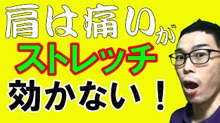 バレーのスパイクで肩が痛み。ストレッチが効かない [upl. by Alida]