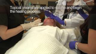 CO2RE Laser Resurfacing [upl. by Nero]