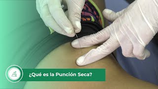 ¿Qué es la punción seca y para qué sirve [upl. by Arinayed526]