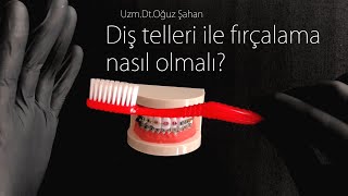 UzmDrOğuz Şahan  Diş telleri ile nasıl diş fırçalanır Diş telleri nasıl temizlenir [upl. by Dihgirb]