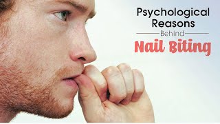 Nail Biting Psychology  Onychophagia [upl. by Ordnasela]