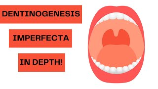 All about Dentinogenesis Imperfecta  From Identifying to Treatment [upl. by Enimsaj115]