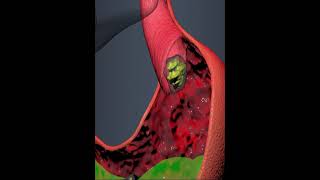 Human Digestive system Sphincter muscle 3D Animation [upl. by Sparky974]