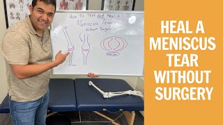 How To Test amp Heal A Meniscus Tear Without Surgery [upl. by Eleaffar]