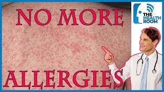 Top 10 HOME REMEDIES to Cure SKIN ALLERGIES NATURALLY [upl. by Eelsel814]