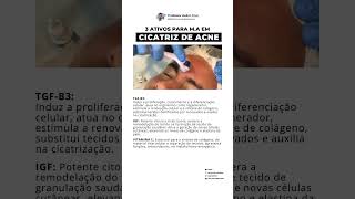 Ativos para tratar cicatriz de acne [upl. by Nnairret896]