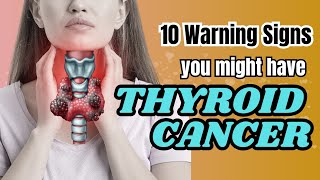 THYROID CANCER10 warning signs you might have thyroid cancer thyroid health throatcancer viral [upl. by Ahcsim]