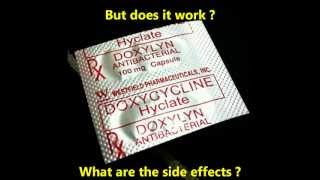 Doxycycline for acne  effectiveness and side effects of Doxycycline for acne [upl. by Gianni]